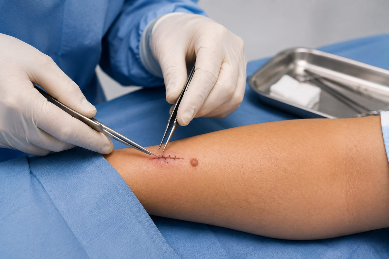 Cirugías Ambulatorias | Dermatología Quirúrgica