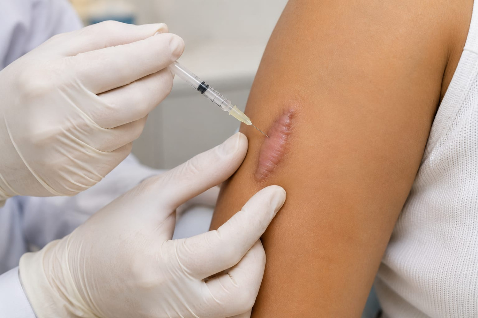 Infiltración | Dermatología Procedimientos